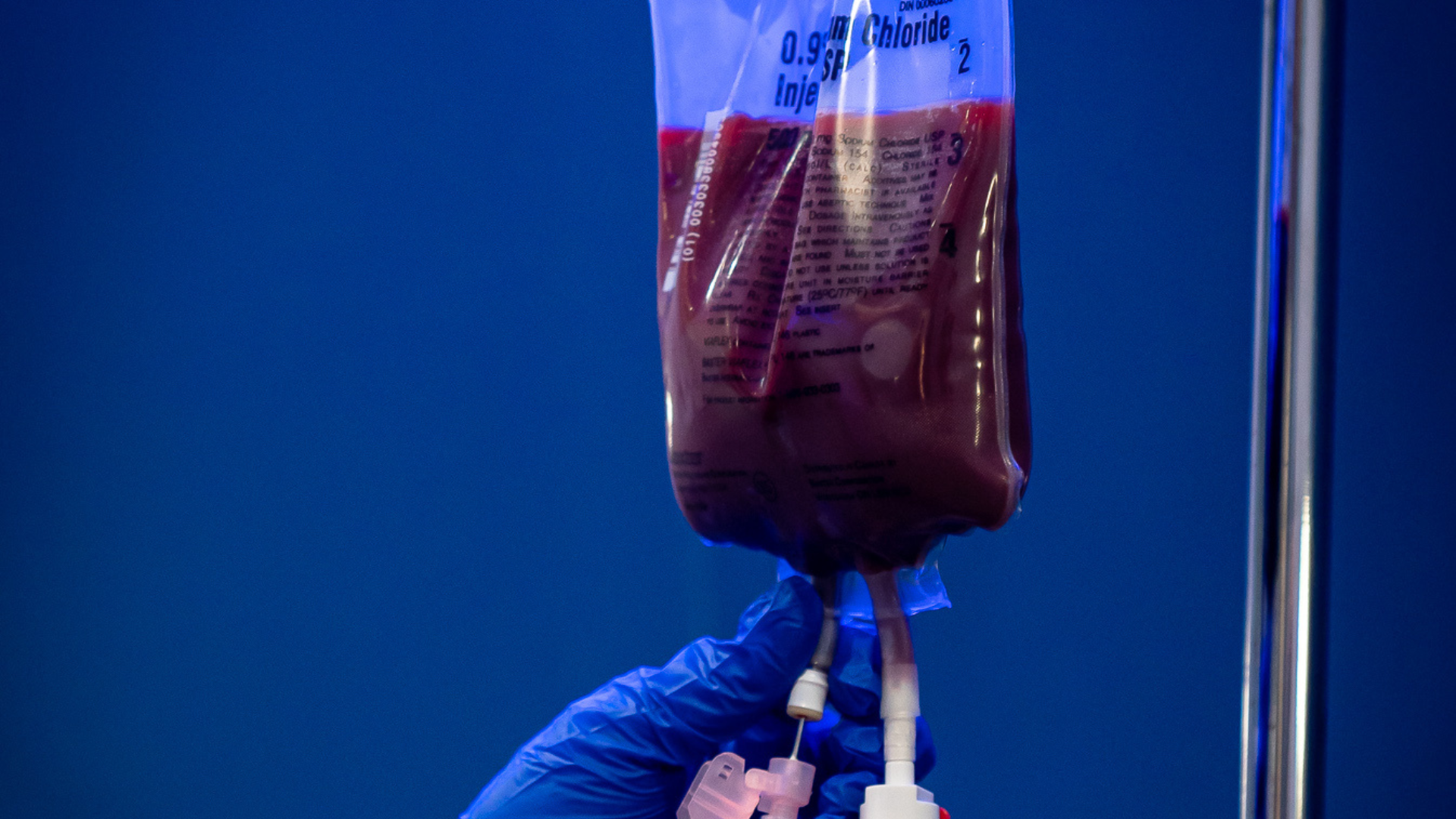 Ozone UV IV therapy equipment prepared for advanced immune support treatment